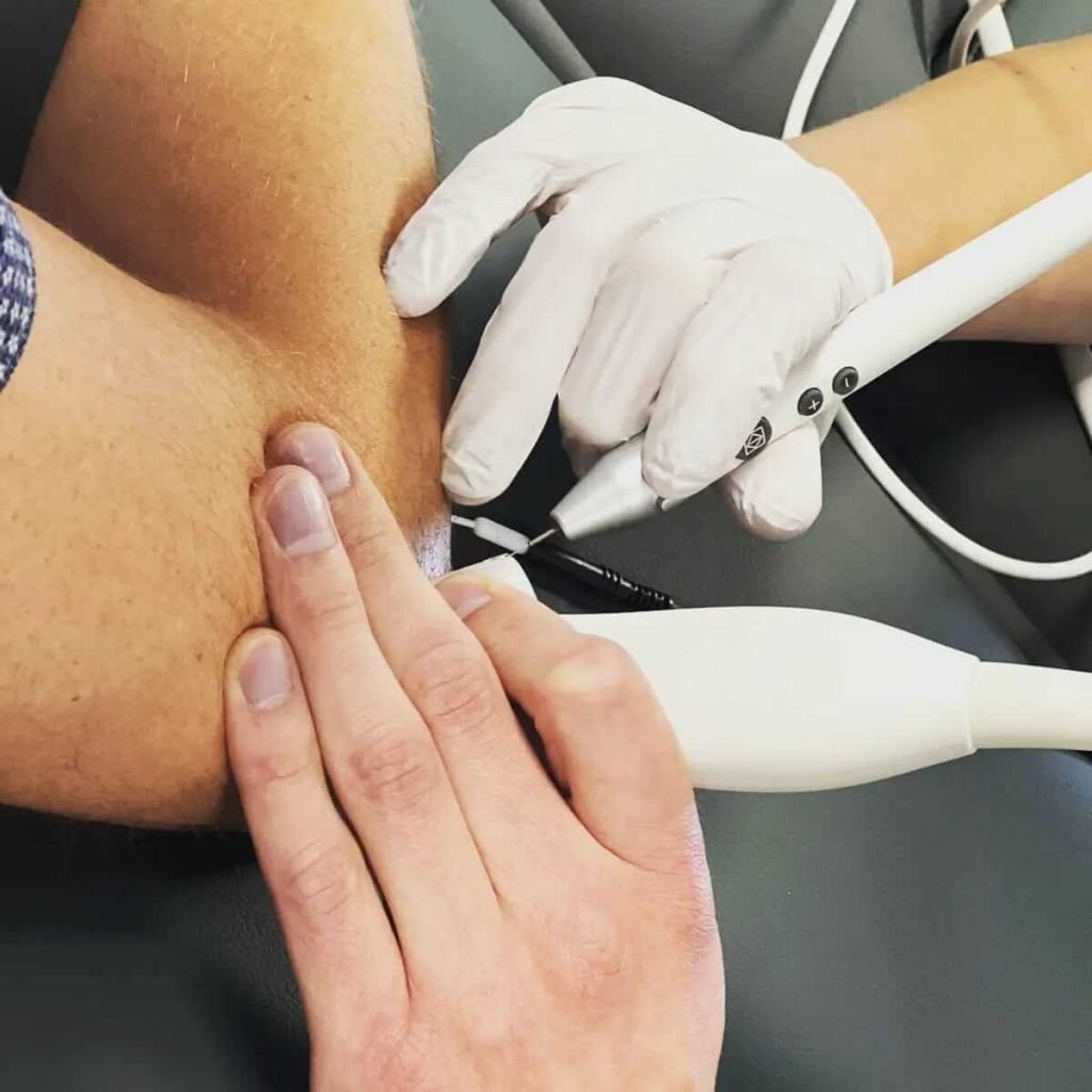 EPTE Therapie binnen Fysiotherapie- Wat Je Moet Weten