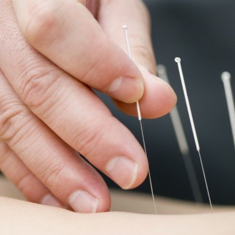 Spanning in nek en schouders? Hoe dry needling helpt bij stressgerelateerde klachten